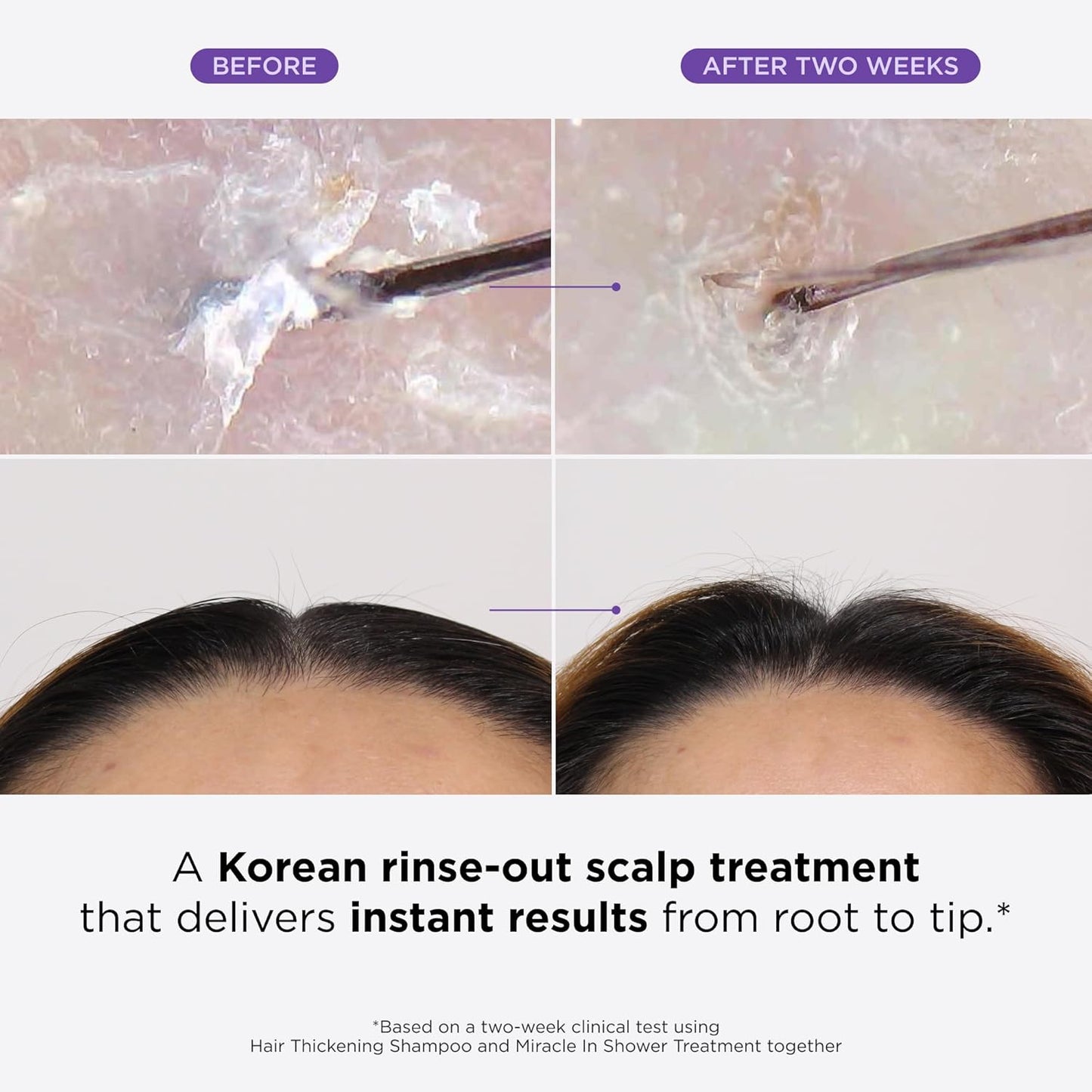 MyHairGroot. Miracle in Shower Treatment