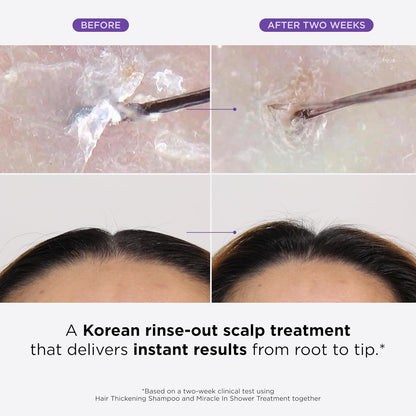 MyHairGroot. Miracle in Shower Treatment