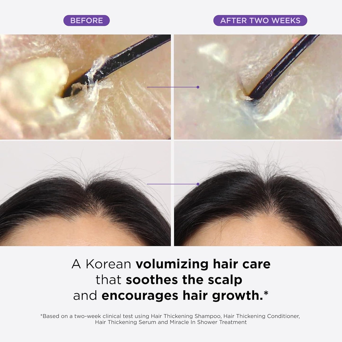 MyHairGroot. Thickening Serum, Shampoo, Conditioner, and Scalp Treatment Set for Hair Loss